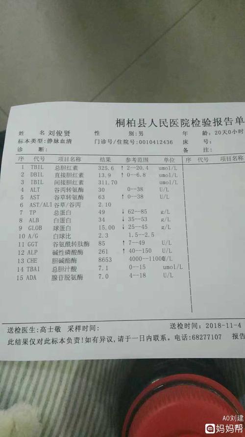 黄疸指数4.7是多少钱