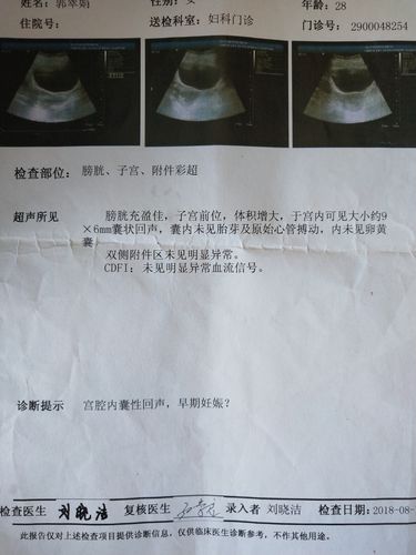 胎芽6mm实际受孕多少天