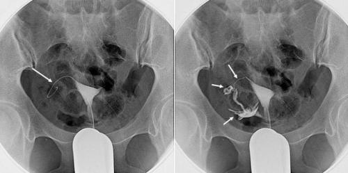 怀不了孕挂什么科？女生怀不上孕挂什么科室