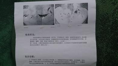 做了造影腰酸怎么回事